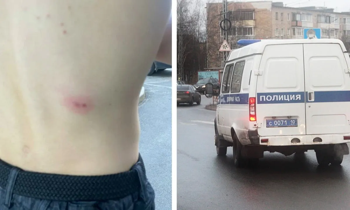 Днем 18 мая в районе дома №19а на улице Гвардейской двое подростков открыли стрельбу из пневматического пистолета по прохожим. Один подросток получил попадания в ногу и спину — пули не пробили кожу, остались ушибы. Обращения в полицию пока неизвестны.