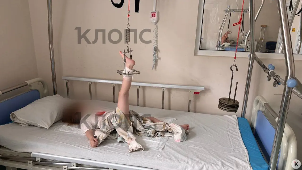 Ребёнок упал на площадке для старших детей. Воспитатели, по словам отца, не вызывали скорую — после рентгена подтвердился перелом с смещением, потребовалась экстренная операция. Родители потребовали проверки.