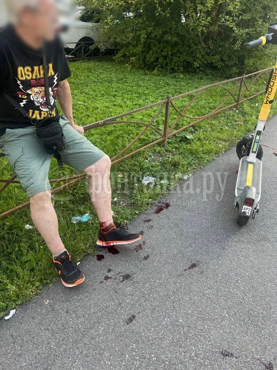 Пенсионер получил рану на ноге, на место прибыли медики и пострадавшего госпитализировали; позже выписали в удовлетворительном состоянии.