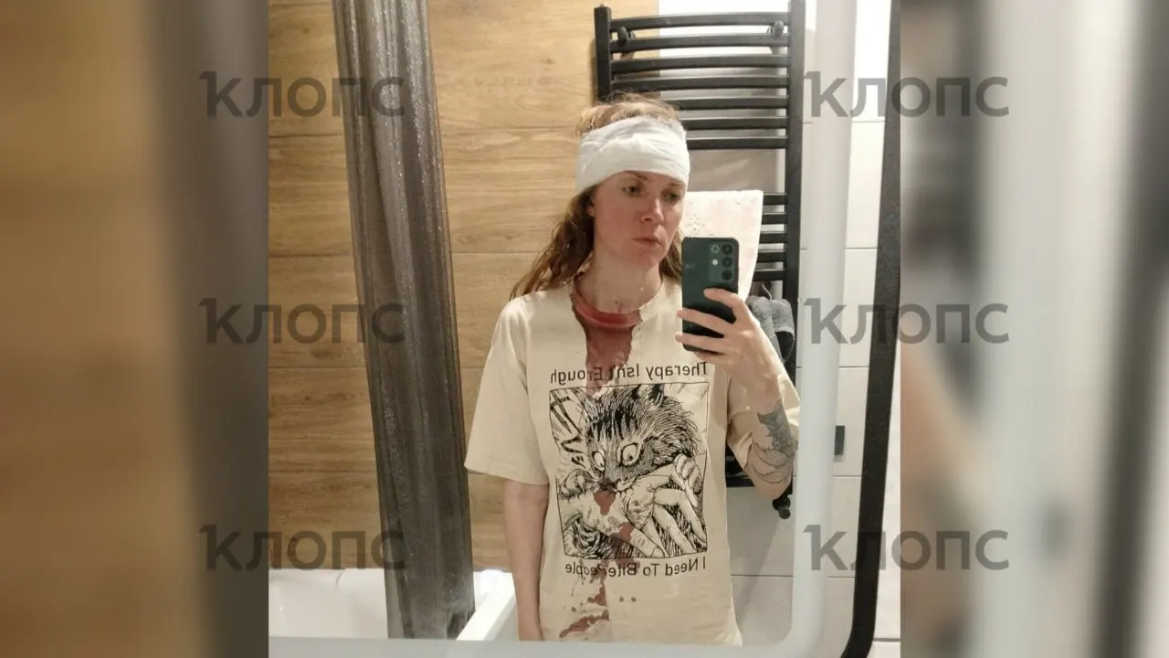 Гражданка из Самары упала с лестницы на променаде Зеленоградска, получила травмы и была доставлена в больницу.