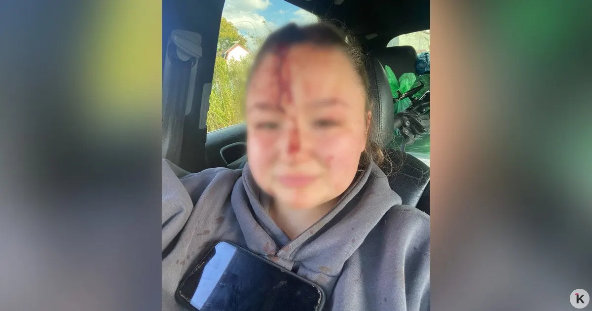 22-летняя калининградская женщина получила травму головы во время конфликта с родственниками дяди, который приехал забрать вещи после развода.